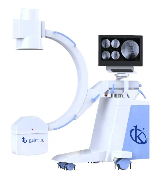 Technical Glossary and Key Terminology for the YR06165 Mobile High-Frequency C-Arm System