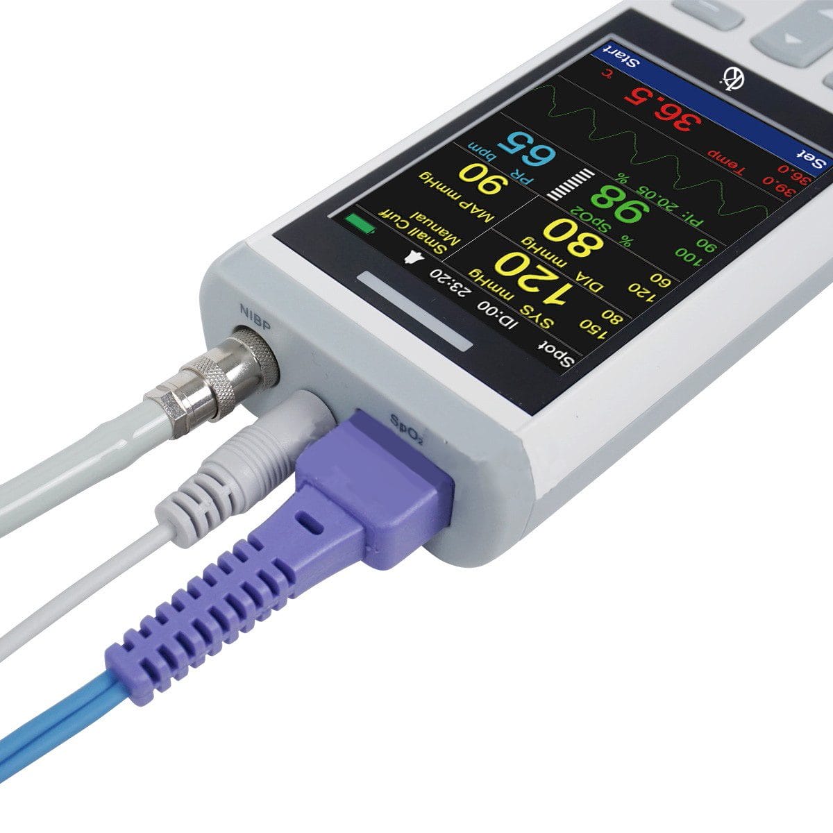 The Ultimate Guide to Veterinary Monitors: Exploring Kalstein's Innovative Solutions